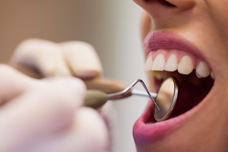 Torino, estratti 11 denti sani in 4 ore: due dentisti a processo per lesioni