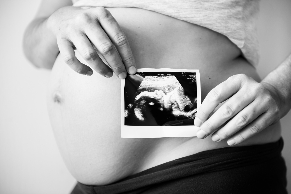 Parma, bambino nasce senza gambe: risarcimento per i genitori di 350.000 euro per errore diagnostico durante la gravidanza